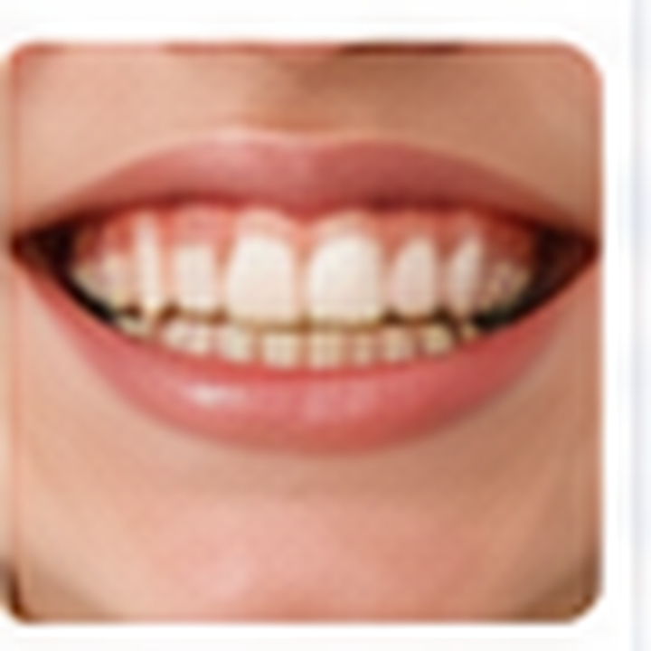 AI-generated braces after photo